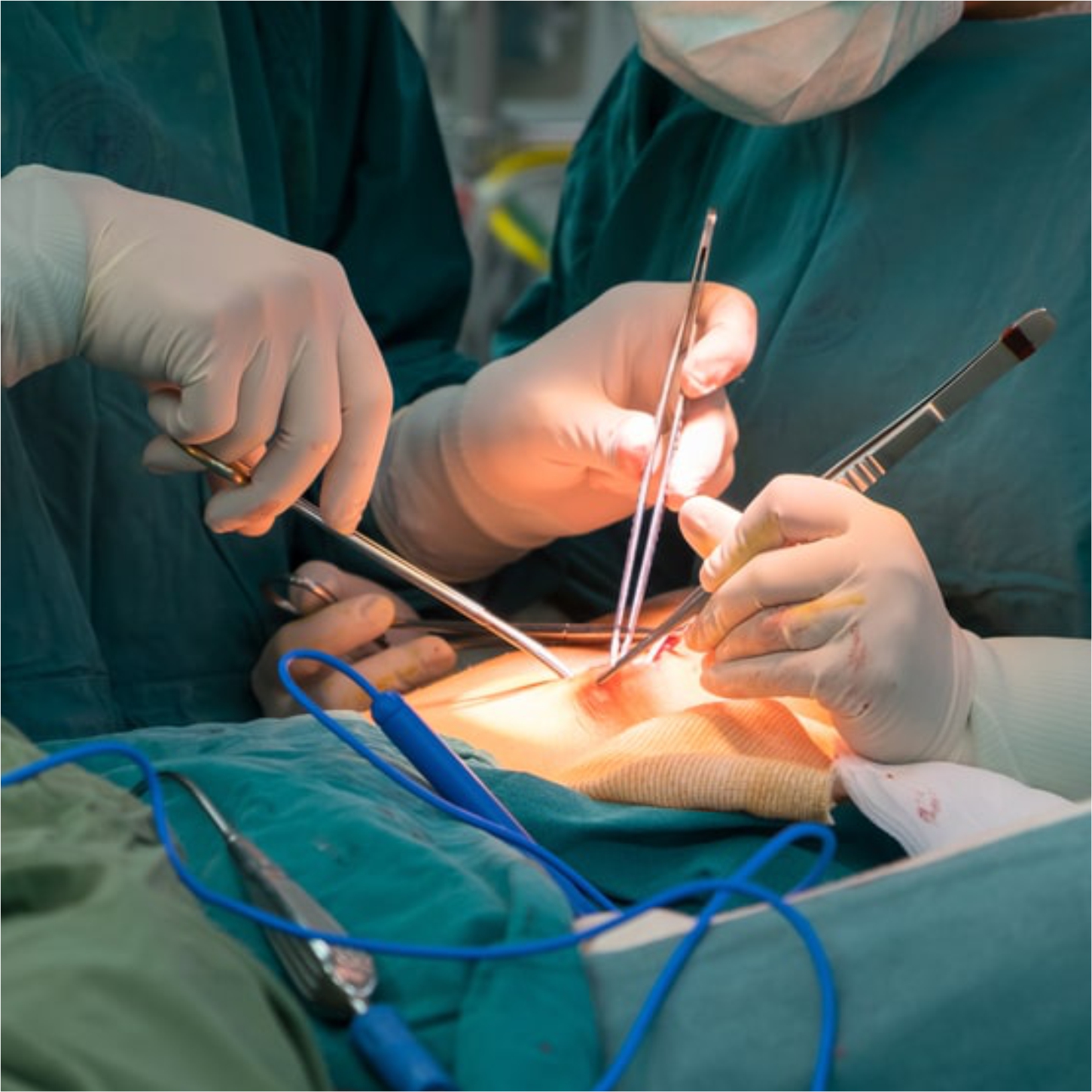 General Surgery & Laparoscopy