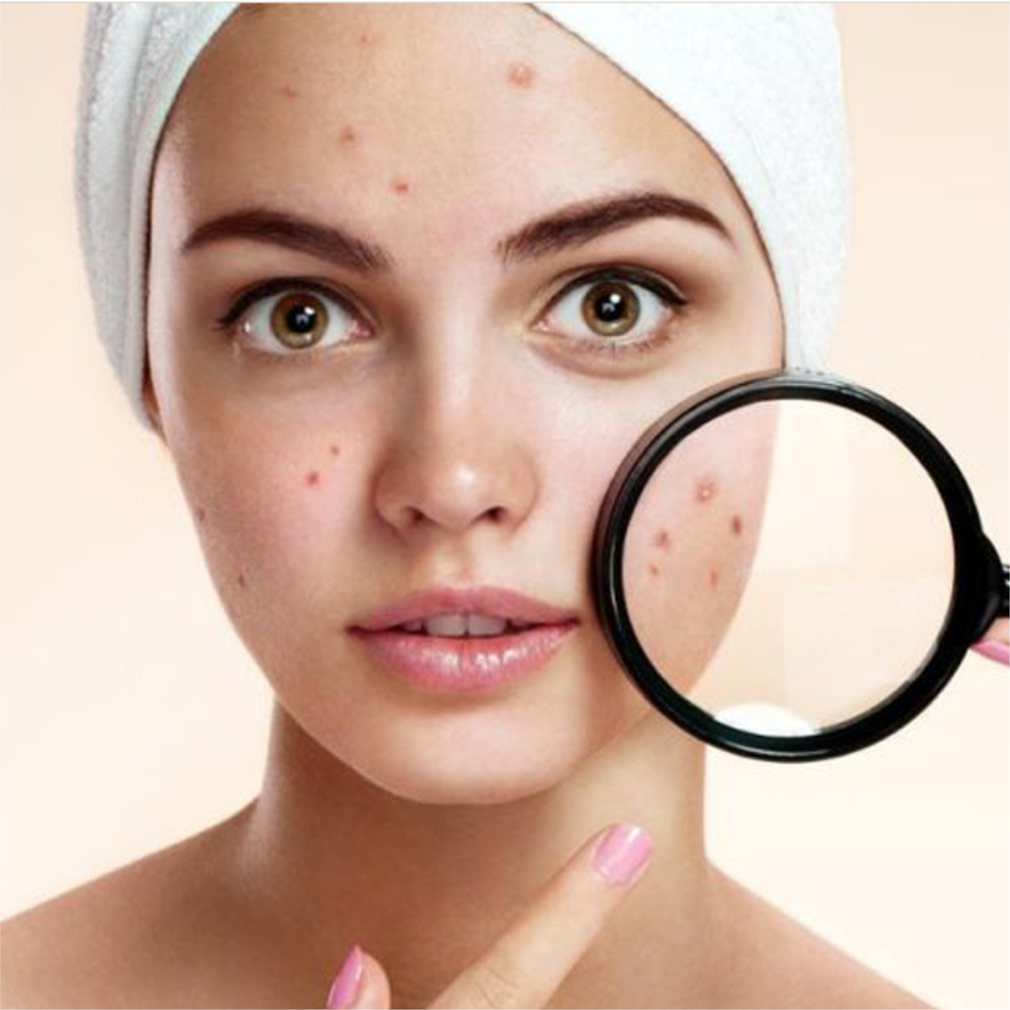 Dermatology